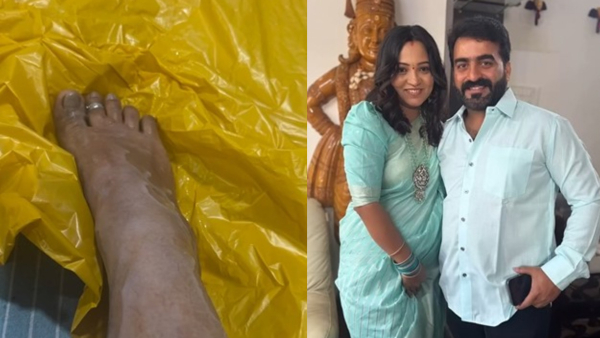 Yashasvini s Steam Accident Explained by Master Anand With Video