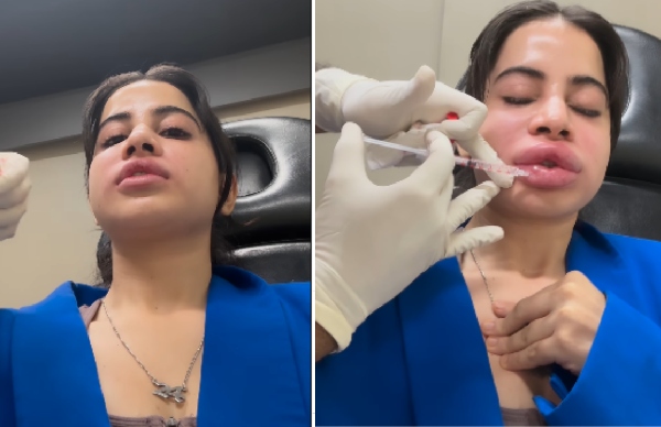 Urfi Javed s lips and face are strangely swollen video goes viral