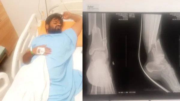 Actor Rakshak Bullet Thar Car Accident Bike Rider Leg Fracture