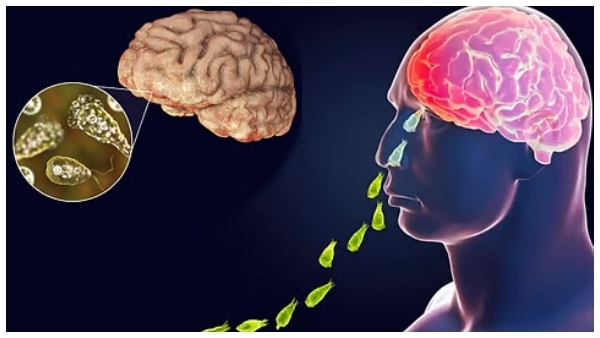 Brain-eating amoeba in water Health Department issues important guidelines Brain-eating amoeba in water Health Department issues important guidelines