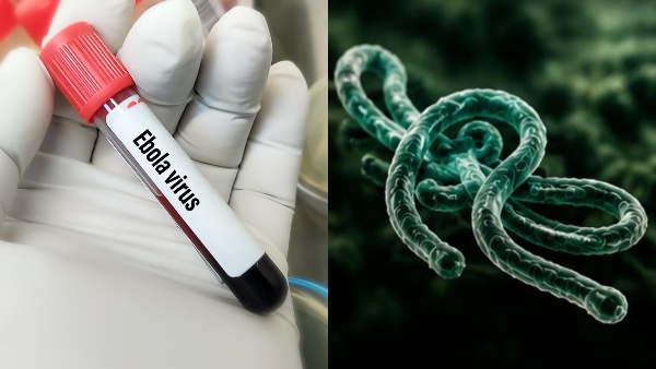 Ebola Virus