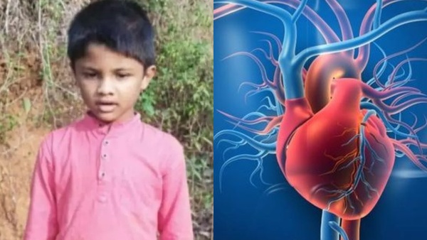Heart Attack