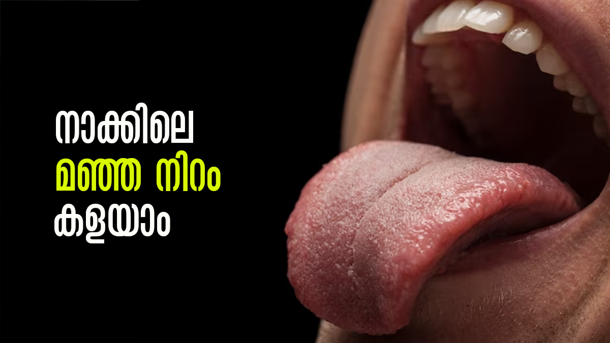 നാവിലാകെ മഞ്ഞ നിറമാണോ..? പേടിക്കേണ്ട, കളയാന്‍ എളുപ്പവഴികളുണ്ട്