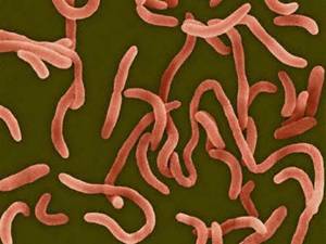 Vibrio Cholarae Vibrio Cholarae