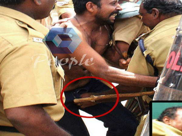 Police Attack Police Attack