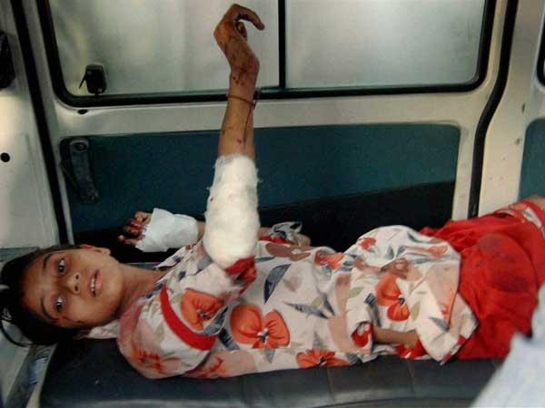 പരുക്ക്