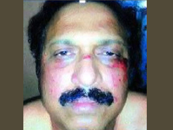 തല്ല് കിട്ടിയെന്ന് ഗണേഷും