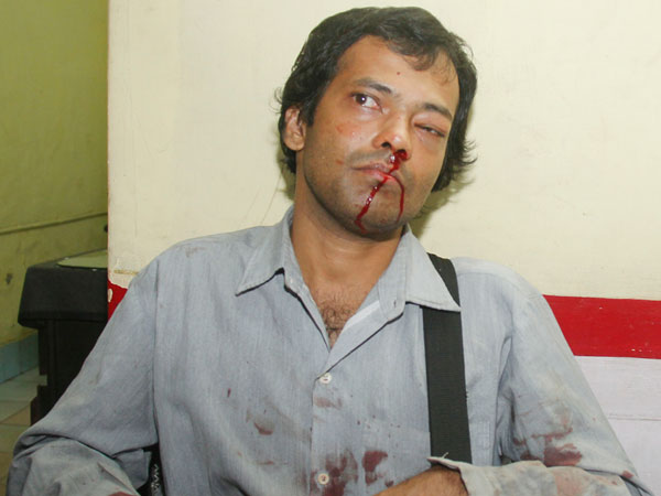 പരിക്ക് ഗുരുതരം