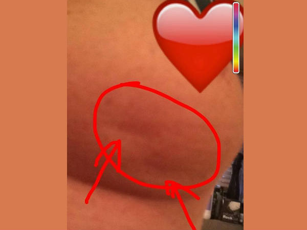 അര്‍ബുദത്തെ നേരിടാന്‍