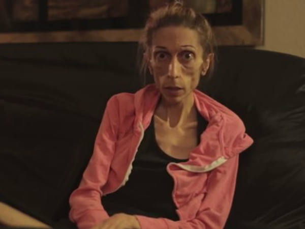 മാരകമാണ് ഈ രോഗം