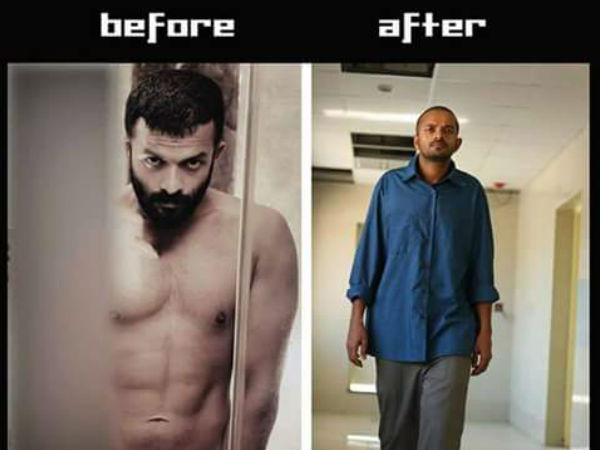 എന്നാലും അപ്പോത്തിക്കരി