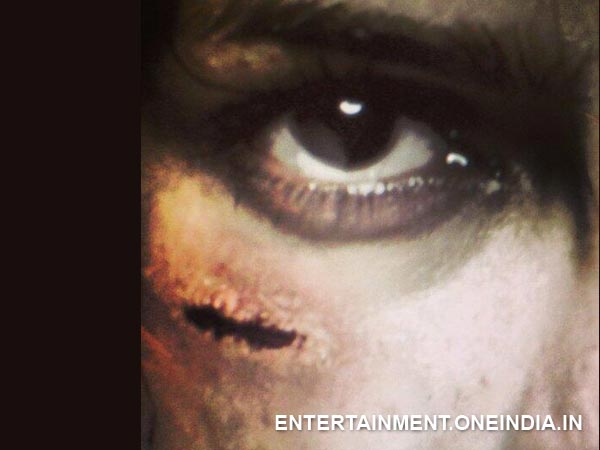 സര്‍ജിക്കല്‍ ഉപകരണങ്ങളിലെ അണുബാധ