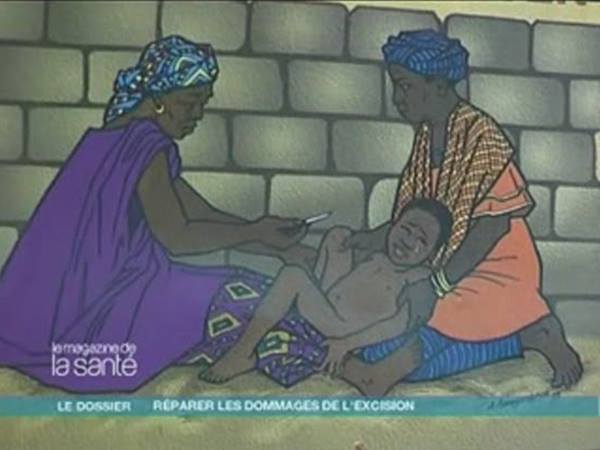 ചേലാകര്‍മ്മം