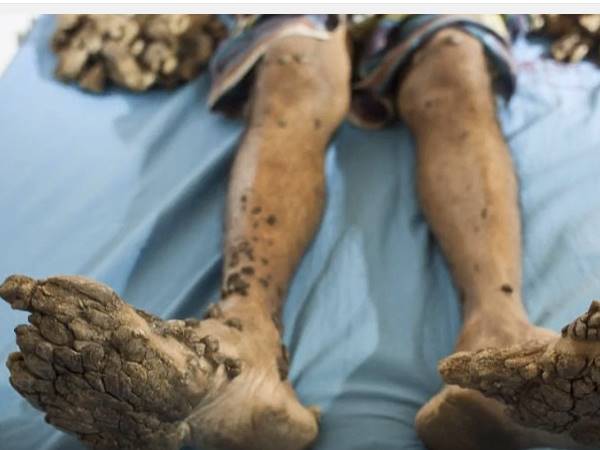 ഏഴ് വര്‍ഷമായി ദുരിതത്തില്‍