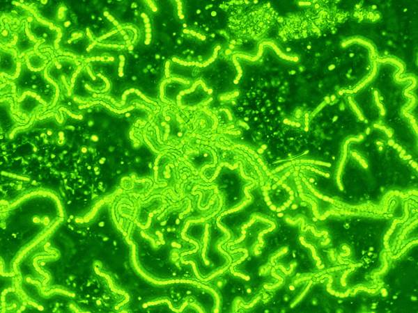 ബാക്ടീരിയങ്ങളിലെ 'ചെടികള്‍'