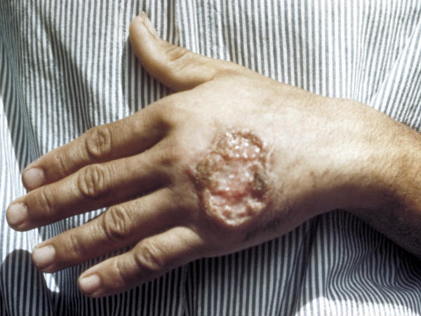 വീണ്ടും