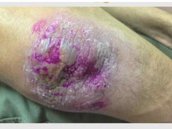 പ്‌ളോസ്