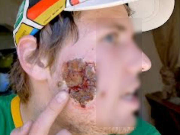 സിറിയയില്‍ മാത്രം