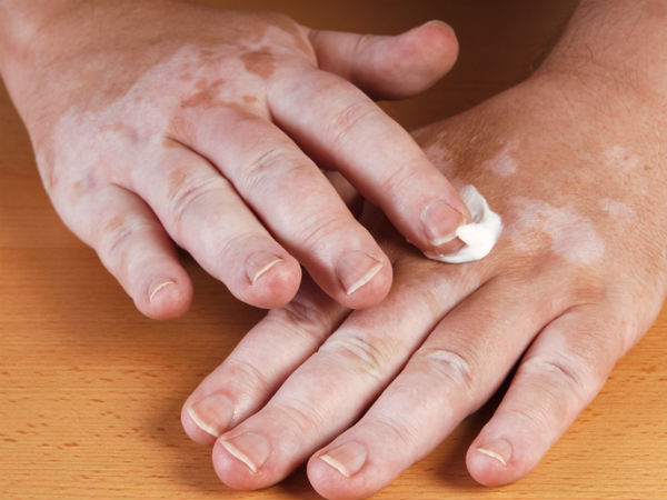 ചെറുപ്പം