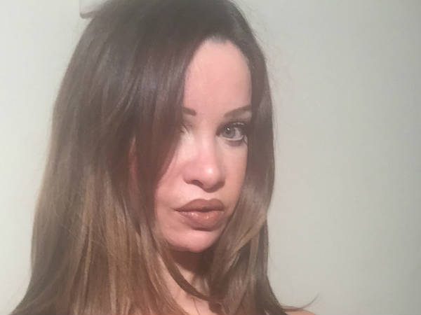 പ്ലാസ്റ്റിക് സര്‍ജറിക്ക് 'അഡിക്ട്'