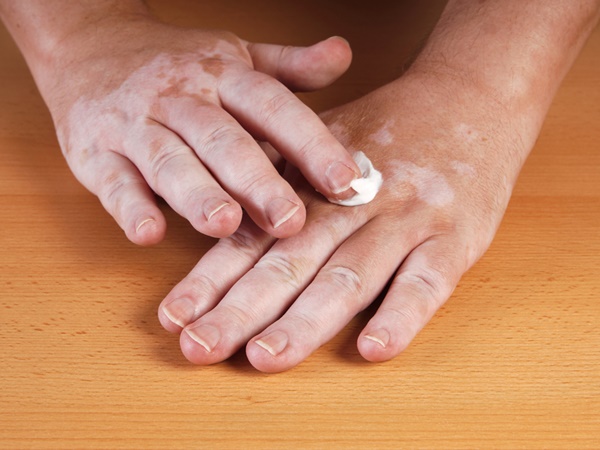 ജനനേന്ദ്രിയം മെച്ചപ്പെടുത്തുന്നത് എന്തിന്?