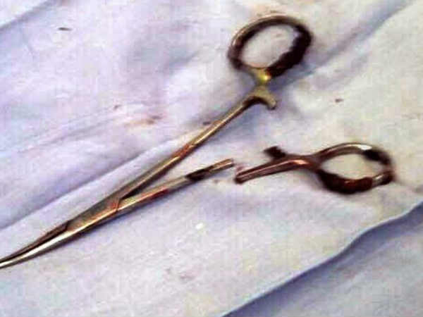 വര്‍ഷങ്ങള്‍ക്ക് മുമ്പ് നടത്തിയ ശസ്ത്രക്രിയ