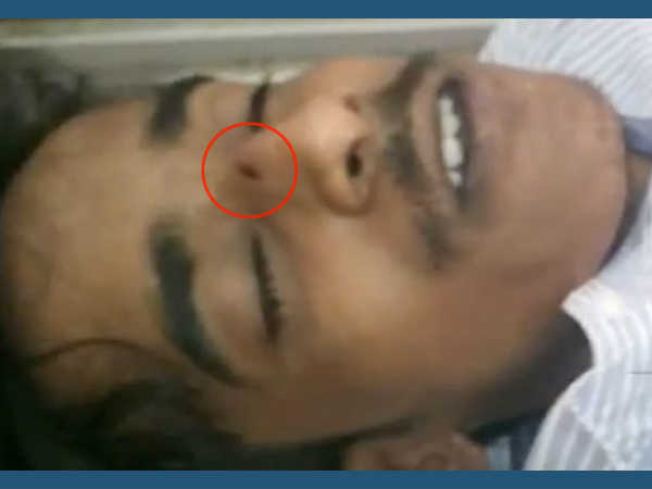 മുറിവിന് സ്ഥിരീകരണം