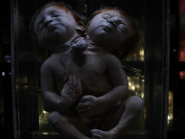  പൊട്ടലുകള്‍