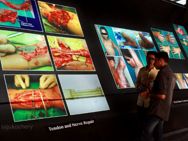  നട്ടെല്ല് രോഗം