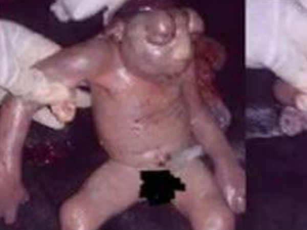 ഗ്രാമീണർക്ക് മുന്നിൽ കത്തിച്ചു