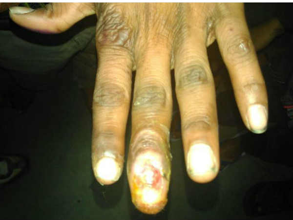 ഞെട്ടിക്കുന്ന ക്രൂരത