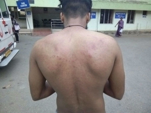 പിടിച്ചുമാറ്റാന്‍ ചെന്നപ്പോള്‍