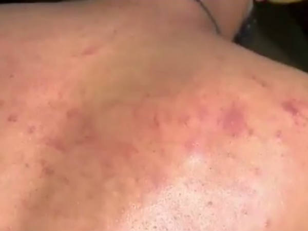  മര്‍ദ്ദിച്ചവരെ ന്യായീകരിച്ചു