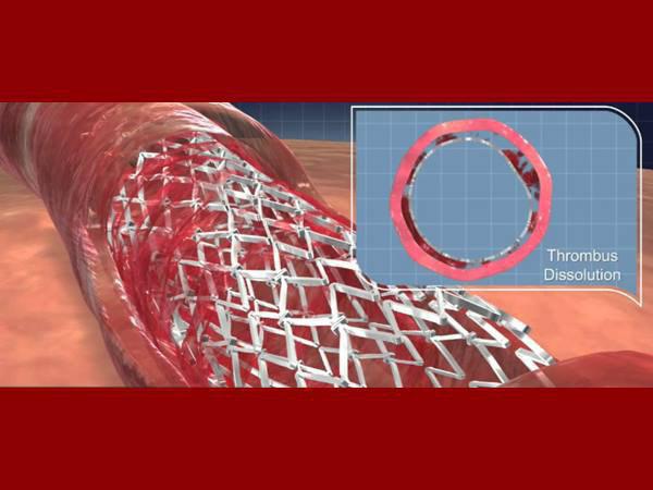  ജീവന്‍ രക്ഷാമരുന്നുകളുടെ പട്ടികയില്‍ 