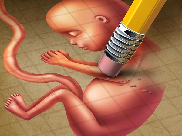 Abortion