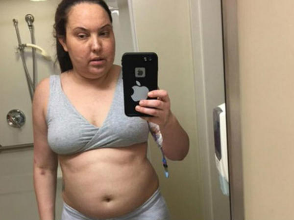 തടി കൂടാന്‍ തുടങ്ങി