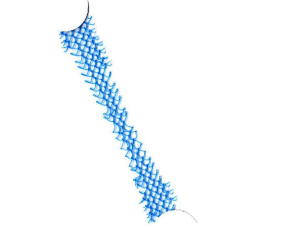 പണി കൊടുത്തത് ആ പ്ലാസ്റ്റിക് മെഷ്