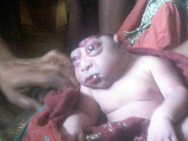 ജനിതക വൈകല്യം