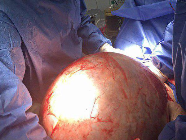 ശസ്ത്രക്രിയ തുടര്‍ന്ന് ഡോക്ടര്‍മാര്‍ 