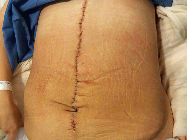 രക്ഷയില്ല