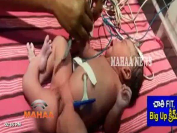 ശസ്ത്രക്രിയ ഉടന്‍...