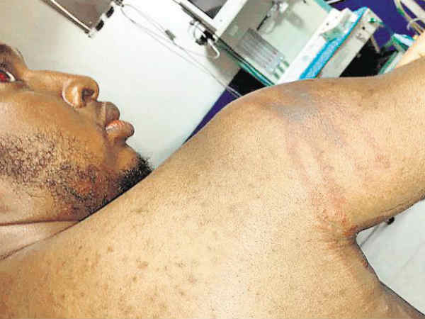 പ്രകോപനം