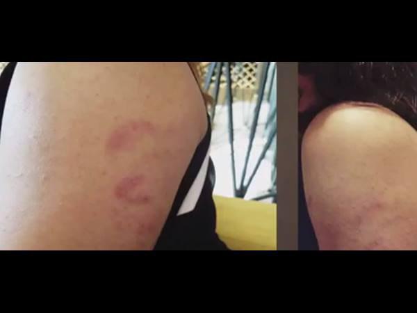 കുട്ടി ആശുപത്രിയില് കുട്ടി ആശുപത്രിയില്