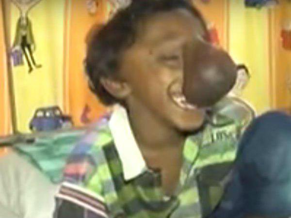 വളർച്ച പതുക്കെ വളർച്ച പതുക്കെ