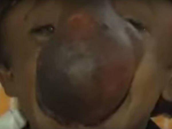 കടുത്ത വേദന കടുത്ത വേദന