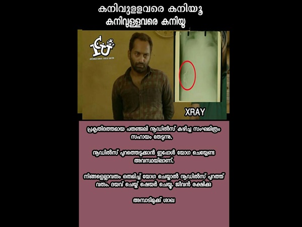 അത് നൂഡില്‍സ് ആയിരുന്നോ!!!