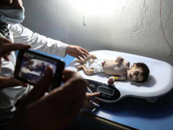 പട്ടിണിയിൽ...