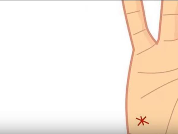 കയ്യിലെ നടുവശത്തിന്റെ ഇടത് ഭാഗം