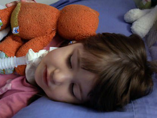 എന്താണ് ഓണ്‍ഡൈന്‍ സിന്‍ഡ്രോം