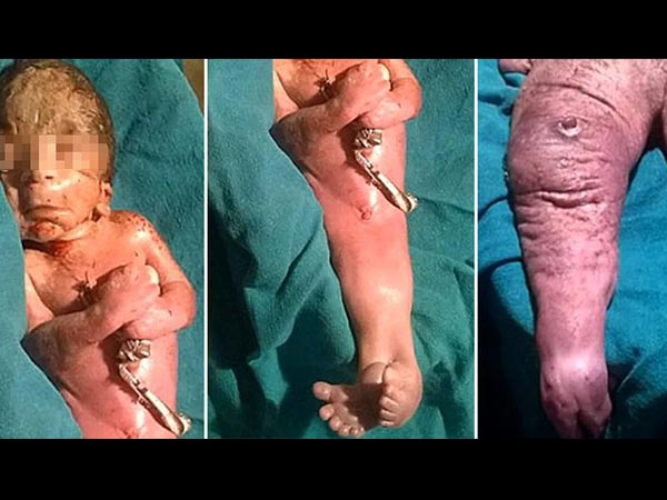 കുഞ്ഞിനെ രക്ഷപ്പെടുത്താനായില്ല കുഞ്ഞിനെ രക്ഷപ്പെടുത്താനായില്ല